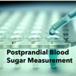 postprandial blood sugar measurement
